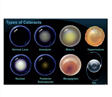 Load image into Gallery viewer, [Vets Recommend!] Lanomax 10ml: Cataract Dissolving Lanosteral Eye Drops for Pets and Animals
