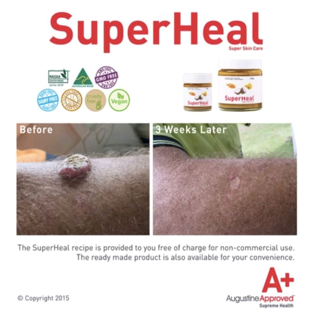 Augustine Approved: SuperHeal (2 sizes)