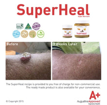 Load image into Gallery viewer, Augustine Approved: SuperHeal (2 sizes)
